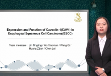 Caveolin-1(CAV1)在食管鳞状细胞癌(ESCC)中的表达及功能 - 王齐-TTV 译直播:语言服务行业专属